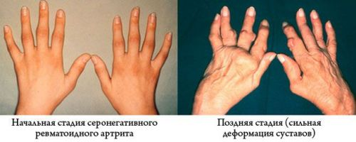 b46a0a0b8777d9a07050e69efee52868